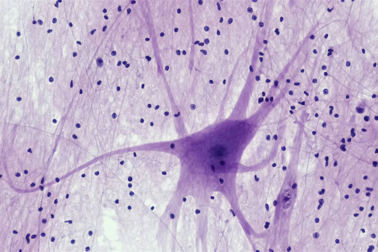 Micrograph of a neuron with branching dendrites stained purple